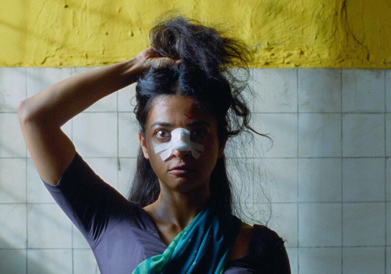 An Indian woman stares into the camera, a bandage on her nose, holding her hair up with one hand