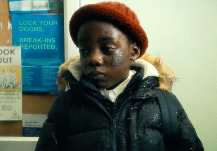 young black boy wearing a red wool hat and navy blue jacket, with bruises on cheeks