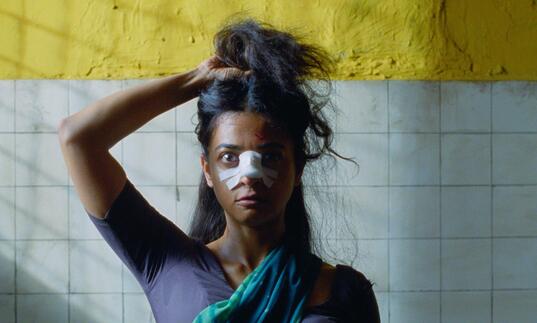 An Indian woman stares into the camera, a bandage on her nose, holding her hair up with one hand